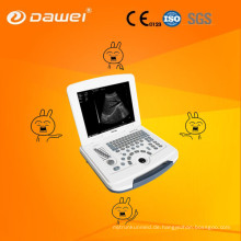 Tragbarer Schwangerschafts-Ultraschallscanner DW-580 u. Medizinischer Ultraschall